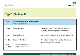 Typ 2 (Stadium II)
Sigmadivertikulitis - Stadiengerechte Entwicklung Seite 32
 