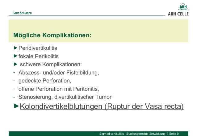 Sigmadivertikulitis