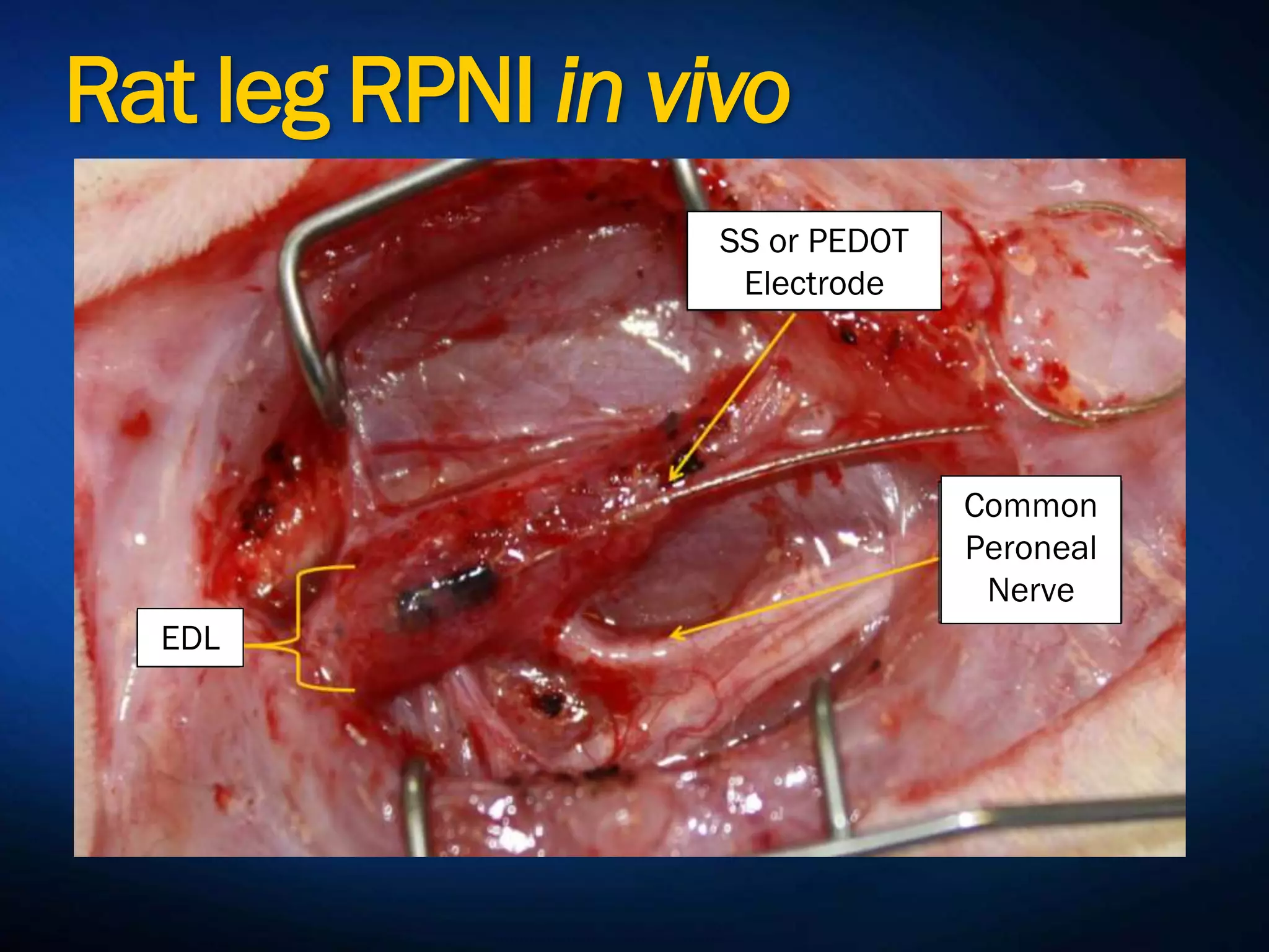 Rat leg RPNI in vivo
SS or PEDOT
Electrode
Common
Peroneal
Nerve
EDL
 