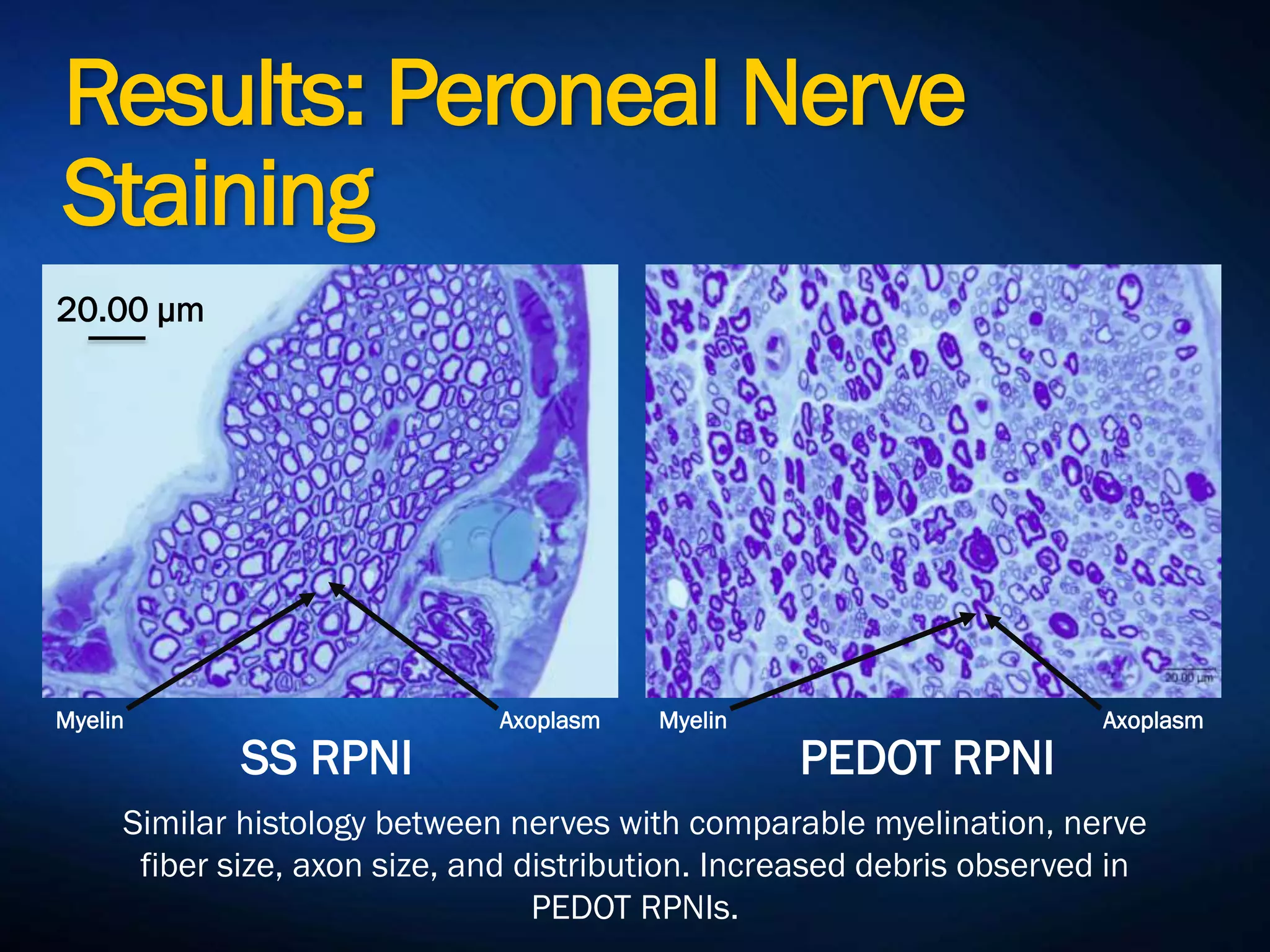 Results: Body Mass
360
370
380
390
400
410
420
430
440
450
BodyMass(g)
SS RPNI
PEDOT RPNI
Rats in both groups gained weight throughout the
study. Weights at time of sacrifice were similar
between groups.
 