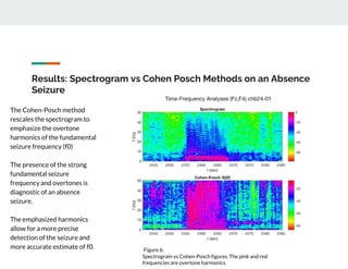 Results: Spectrogram vs Cohen Posch Methods on an Absence
Seizure
The Cohen-Posch method
rescales the spectrogram to
emphasize the overtone
harmonics of the fundamental
seizure frequency (f0)
The presence of the strong
fundamental seizure
frequency and overtones is
diagnostic of an absence
seizure.
The emphasized harmonics
allow for a more precise
detection of the seizure and
more accurate estimate of f0. Figure 6:
Spectrogram vs Cohen-Posch figures. The pink and red
frequencies are overtone harmonics.
 