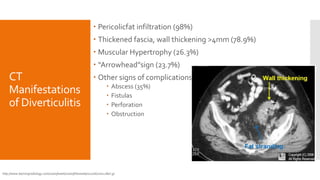 CT
Manifestations
of Diverticulitis
 Pericolicfat infiltration (98%)
 Thickened fascia, wall thickening >4mm (78.9%)
 Muscular Hypertrophy (26.3%)
 “Arrowhead”sign (23.7%)
 Other signs of complications
 Abscess (35%)
 Fistulas
 Perforation
 Obstruction
http://www.learningradiology.com/caseofweek/caseoftheweekpix2006/cow228arr.jp
 