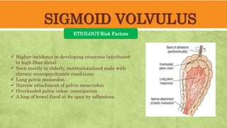 SIGMOID VOLVULUS
ETIOLOGY-Risk Factors
 Higher incidence in developing countries (attributed
to high fiber diets)
 Seen mostly in elderly, institutionalized male with
chronic neuropsychiatric conditions
 Long pelvic mesocolon
 Narrow attachment of pelvic meso-colon
 Overloaded pelvic colon- constipation
 A loop of bowel fixed at its apex by adhesions.
 