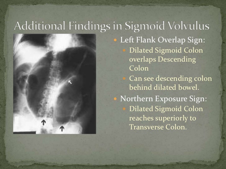 Sigmoid volvulus (2)
 Volvulus X Ray Omega Sign