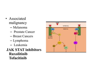 • Associated
malignancy
– Melanoma
– Prostate Cancer
– Breast Cancers
– Lymphoma
– Leukemia
JAK STAT inhibitors
Ruxolitinib
Tofacitinib
 