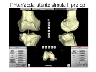 l’interfaccia utente simula il pre op 