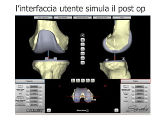 l’interfaccia utente simula il post op 