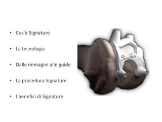 Cos’è Signature La tecnologia Dalle immagini alle guide La procedura Signature I benefici di Signature 