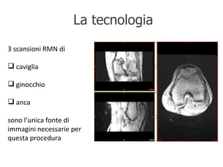 La tecnologia 3 scansioni RMN di caviglia ginocchio anca sono l’unica fonte di immagini necessarie per questa procedura 