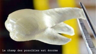 Le champ des possibles est énorme
 