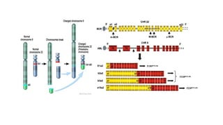 CHRONIC MYELOID LEUKEMIA | PPTX