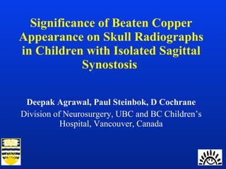 Significance of Beaten Copper Appearance on Skull Radiographs in Children with Isolated Sagittal Synostosis  Deepak Agrawal, Paul Steinbok, D Cochrane Division of Neurosurgery, UBC and BC Children’s Hospital, Vancouver, Canada 