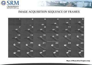 Dept of Biomedical Engineering
IMAGE ACQUISITION SEQUENCE OF FRAMES
 