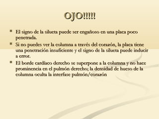 OJO!!!!!OJO!!!!!
 El signo de la silueta puede ser engañoso en una placa pocoEl signo de la silueta puede ser engañoso en una placa poco
penetrada.penetrada.
 Si no puedes ver la columna a través del corazón, la placa tieneSi no puedes ver la columna a través del corazón, la placa tiene
una penetración insuficiente y el signo de la silueta puede induciruna penetración insuficiente y el signo de la silueta puede inducir
a error.a error.
 El borde cardíaco derecho se superpone a la columna y no haceEl borde cardíaco derecho se superpone a la columna y no hace
prominencia en el pulmón derecho; la densidad de hueso de laprominencia en el pulmón derecho; la densidad de hueso de la
columna oculta la interfase pulmón/corazóncolumna oculta la interfase pulmón/corazón
 