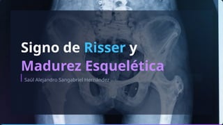 Evaluación del Signo de Risser y Madurez Esquelética en Escoliosis | PPTX