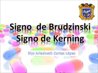 Signo de Brudzinski y de Kerning - Elyz A. Cortez López