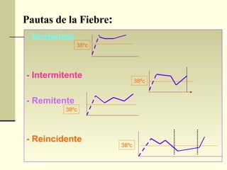 Pautas de la Fiebre :   - Sostenida  - Intermitente   - Remitente   - Reincidente   38ºc 38ºc 38ºc 38ºc 