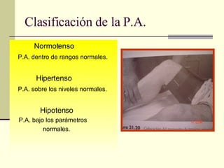 Clasificación de la P.A. Normotenso  P.A. dentro de rangos normales. Hipertenso  P.A. sobre los niveles normales. Hipotenso  P.A. bajo los parámetros  normales. 