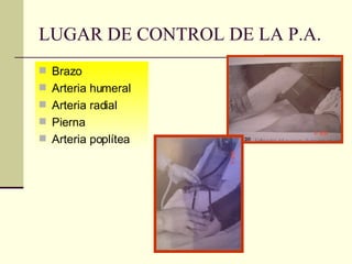 LUGAR DE CONTROL DE LA P.A. Brazo Arteria humeral Arteria radial Pierna Arteria poplítea 
