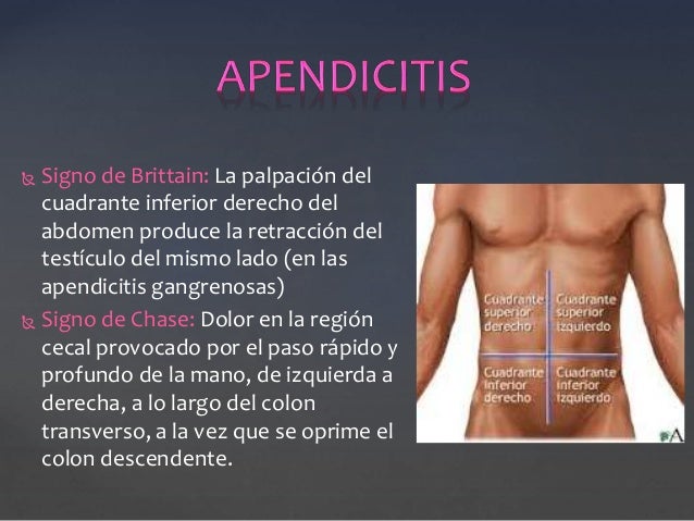 Signos de abdomen