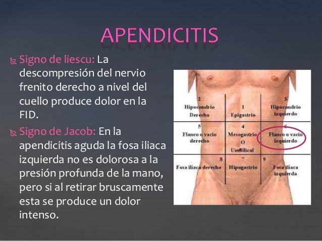 Los ejercicios eficaces que no estaba enfermo la espalda
