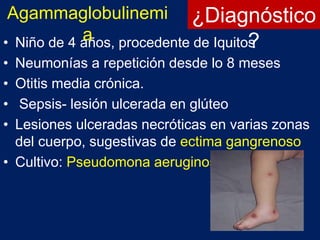 ¿Diagnóstico
?• Niño de 4 años, procedente de Iquitos
• Neumonías a repetición desde lo 8 meses
• Otitis media crónica.
• Sepsis- lesión ulcerada en glúteo
• Lesiones ulceradas necróticas en varias zonas
del cuerpo, sugestivas de ectima gangrenoso
• Cultivo: Pseudomona aeruginosa
Agammaglobulinemi
a
 