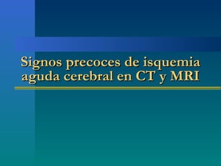 Signos precoces de isquemiaSignos precoces de isquemia
aguda cerebral en CT y MRIaguda cerebral en CT y MRI
 