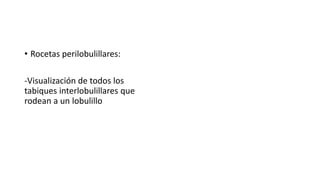 • Rocetas perilobulillares:
-Visualización de todos los
tabiques interlobulillares que
rodean a un lobulillo
 