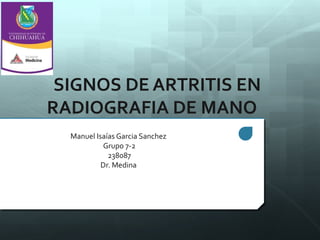 SIGNOS DE ARTRITIS EN
RADIOGRAFIA DE MANO
  Manuel Isaías Garcia Sanchez
           Grupo 7-2
             238087
           Dr. Medina
 