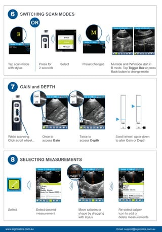 Signos RT Quick Start Guide | PDF