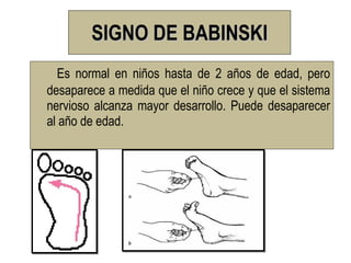 SIGNO DE BABINSKI
  Es normal en niños hasta de 2 años de edad, pero
desaparece a medida que el niño crece y que el sistema
nervioso alcanza mayor desarrollo. Puede desaparecer
al año de edad.
 