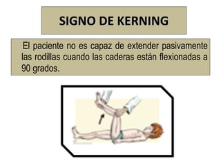SIGNO DE KERNING
 El paciente no es capaz de extender pasivamente
las rodillas cuando las caderas están flexionadas a
90 grados.
 