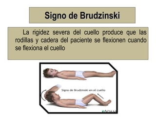 Signo de Brudzinski
   La rigidez severa del cuello produce que las
rodillas y cadera del paciente se flexionen cuando
se flexiona el cuello
 