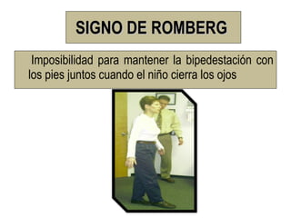 SIGNO DE ROMBERG
 Imposibilidad para mantener la bipedestación con
los pies juntos cuando el niño cierra los ojos
 