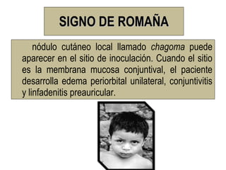 SIGNO DE ROMAÑA
    nódulo cutáneo local llamado chagoma puede
aparecer en el sitio de inoculación. Cuando el sitio
es la membrana mucosa conjuntival, el paciente
desarrolla edema periorbital unilateral, conjuntivitis
y linfadenitis preauricular.
 