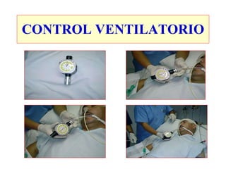 CONTROL VENTILATORIO 