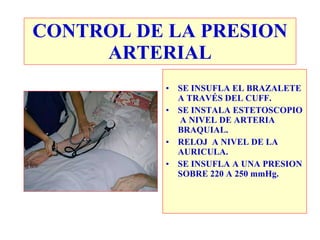 SE INSUFLA EL BRAZALETE A TRAVÉS DEL CUFF. SE INSTALA ESTETOSCOPIO  A NIVEL DE ARTERIA BRAQUIAL. RELOJ  A NIVEL DE LA AURICULA. SE INSUFLA A UNA PRESION SOBRE 220 A 250 mmHg. CONTROL DE LA PRESION ARTERIAL 