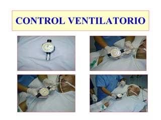CONTROL VENTILATORIO
 