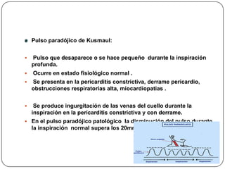 Hipotensión severa producida por una pérdida súbita de sangre (shock)EtiopatogeniaDisminución de la precarga ventricular.