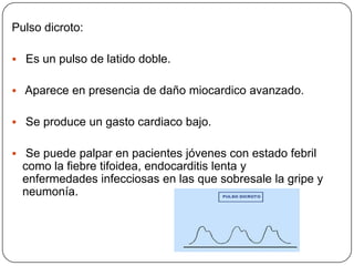 Disminución de la RVS.