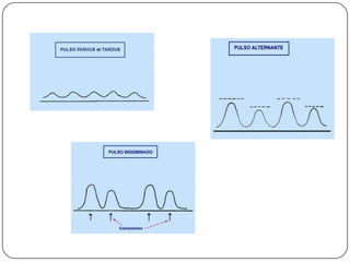 Causas misceláneas.   FALLO CIRCULATORIO – SHOCK CIRCULATORIO