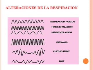 ALTERACIONES DE LA RESPIRACION

 