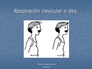 Respiración clavicular o alta. 
Diseño: Adalberto Pizarro 
Enfermero 
 