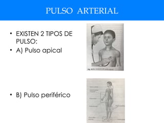 PULSO ARTERIAL
• EXISTEN 2 TIPOS DE
PULSO:
• A) Pulso apical
• B) Pulso periférico
 