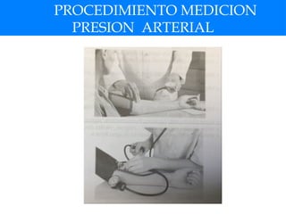PROCEDIMIENTO MEDICION
PRESION ARTERIAL
 