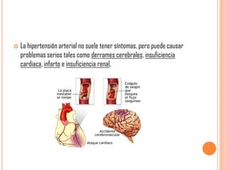 

La hipertensión arterial no suele tener síntomas, pero puede causar
problemas serios tales como derrames cerebrales, insuficiencia
cardiaca, infarto e insuficiencia renal.

 