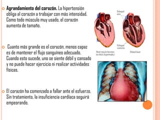 





Agrandamiento del corazón. La hipertensión
obliga al corazón a trabajar con más intensidad.
Como todo músculo muy usado, el corazón
aumenta de tamaño.

Cuanto más grande es el corazón, menos capaz
es de mantener el flujo sanguíneo adecuado.
Cuando esto sucede, uno se siente débil y cansado
y no puede hacer ejercicio ni realizar actividades
físicas.

El corazón ha comenzado a fallar ante el esfuerzo.
Sin tratamiento, la insuficiencia cardíaca seguirá
empeorando.

 