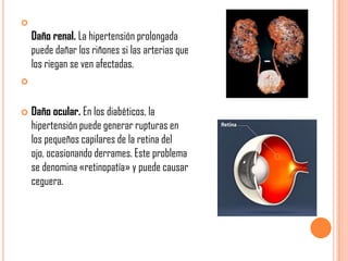 

Daño renal. La hipertensión prolongada
puede dañar los riñones si las arterias que
los riegan se ven afectadas.




Daño ocular. En los diabéticos, la
hipertensión puede generar rupturas en
los pequeños capilares de la retina del
ojo, ocasionando derrames. Este problema
se denomina «retinopatía» y puede causar
ceguera.

 