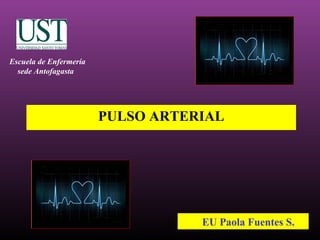 PULSO ARTERIAL
EU Paola Fuentes S.
Escuela de Enfermería
sede Antofagasta
 