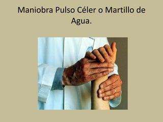 Maniobra Pulso Céler o Martillo de
Agua.
 